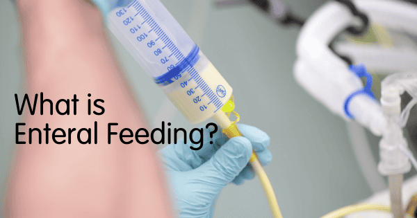 What is Enteral Feeding?