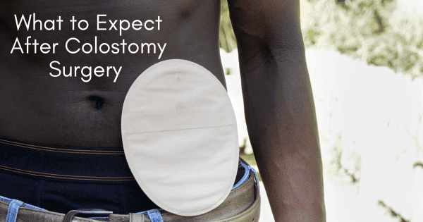 What to Expect After Colostomy Surgery