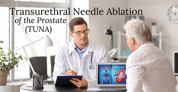 Transurethral Needle Ablation of the Prostate